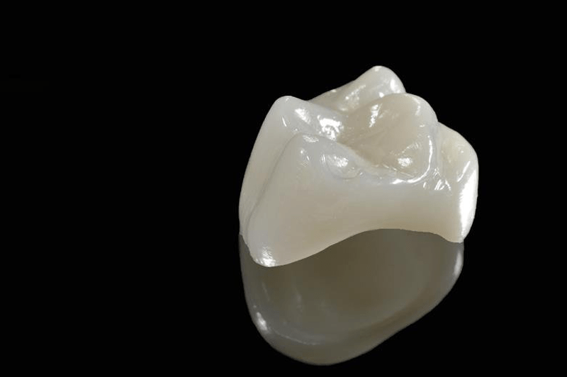 Porcelain Crown