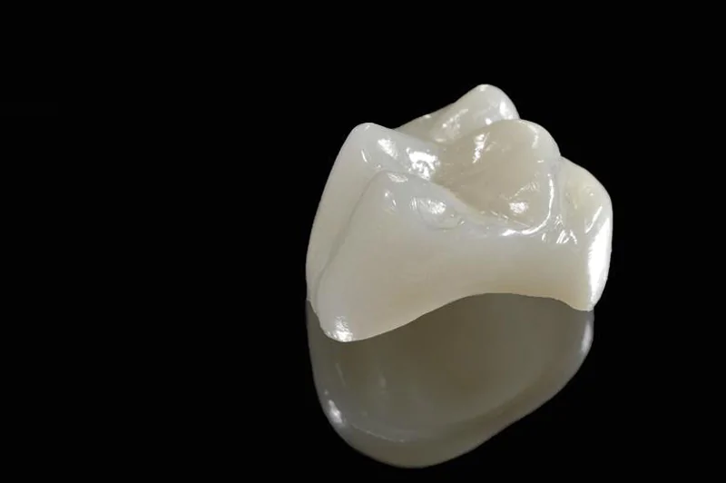 Porcelain Crown